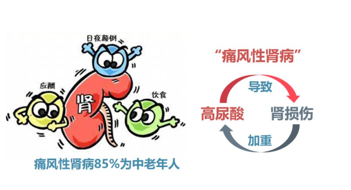 《高尿酸之患：警惕器官受损，及时补水是关键》 