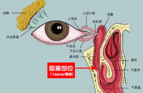 《守护宝宝明眸：重庆铜梁婴儿泪道探通术的温暖故事》